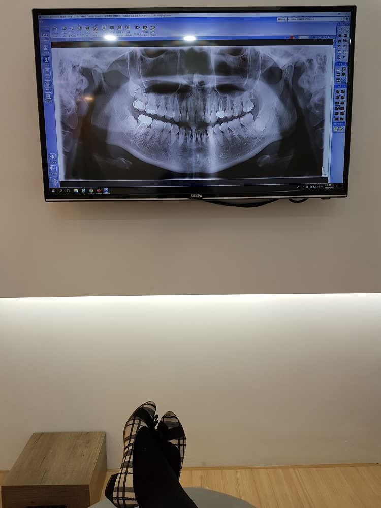 不痛不可怕還有獨立診間看電視，推薦讓我敢看牙醫的林口萊德美學牙醫診所